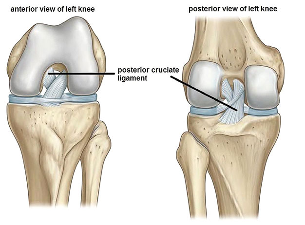 Arthroscopic Ligament